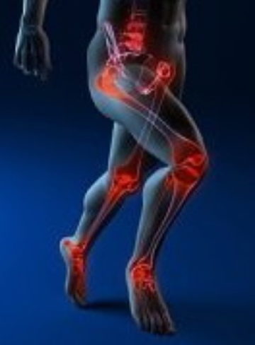 Sportblessures (2/3): Wat zijn de meest voorkomende hardloopblessures?