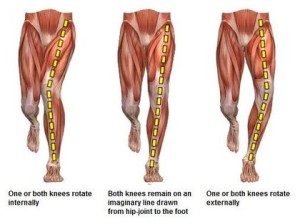 blessures - misalignment